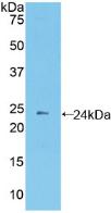 Protocadherin Beta 2 (PCDHb2) Polyclonal Antibody - image 2