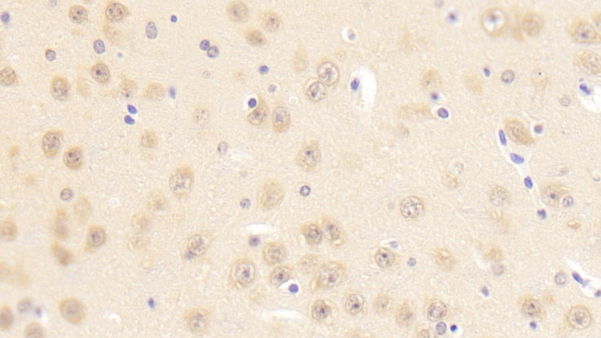 DABstainingonIHC-P.Samples:MouseTissue)