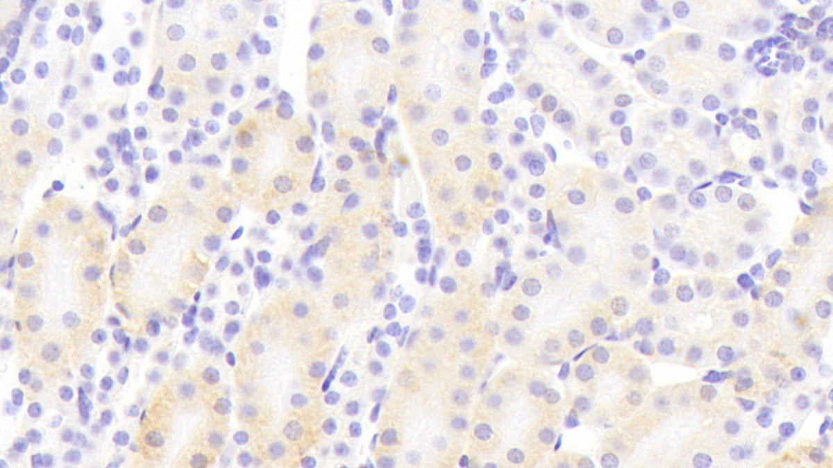 Protocadherin Beta 2 (PCDHb2) Polyclonal Antibody - image 4