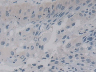 DAB staining on fromalin fixed paraffin- embedded Kidney tissue)