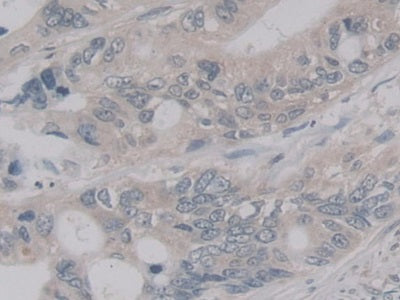 Protease, Serine 12 (PRSS12) Polyclonal Antibody - image 4
