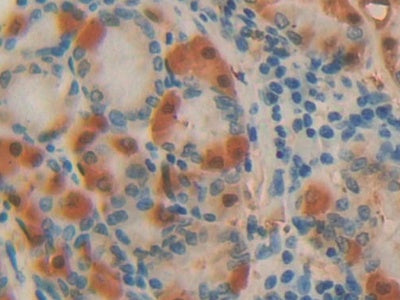 DAB staining on IHC-P; Samples: Human Stomach Tissue)
