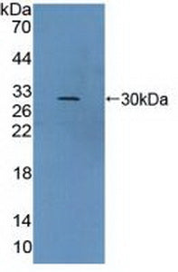 DAB staining on IHC-P; Samples: Human Colon Tissue;  Primary Ab: 20μg/ml Rabbit Anti-Human vWA2 Antibody Second Ab: 2µg/mL HRP-Linked Caprine Anti-Rabbit IgG Polyclonal Antibody
