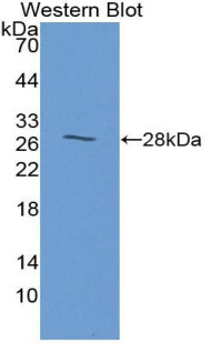 Anoctamin 1 (ANO1) Polyclonal Antibody - image 2