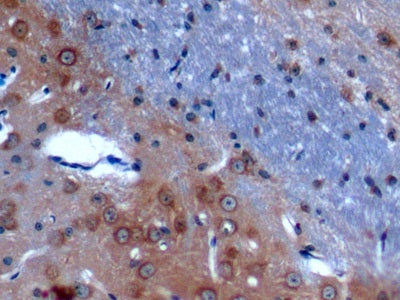 Anoctamin 1 (ANO1) Polyclonal Antibody - image 3