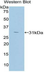 Protein Kinase C Zeta (PKCz) Polyclonal Antibody - image 2