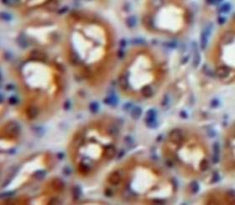 Protein Kinase C Zeta (PKCz) Polyclonal Antibody - image 3