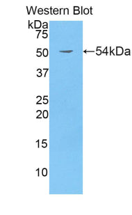 Breast Cancer Susceptibility Protein 1 (BRCA1) Polyclonal Antibody - image 2