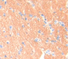 Breast Cancer Susceptibility Protein 1 (BRCA1) Polyclonal Antibody - image 3