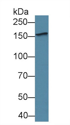 Western Blot; Sample: Rat Placenta lysate; Primary Ab: 1µg/ml Rabbit Anti-Porcine VEGFR2 Antibody Second Ab: 0.2µg/mL HRP-Linked Caprine Anti-Rabbit IgG Polyclonal Antibody