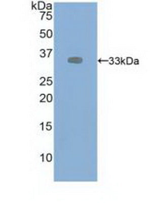 Western Blot; Sample: ECV304 cell lysate; Primary Ab: 4μg/ml Rabbit Anti-Human VEGFR2 Antibody; Second Ab: 0.2µg/mL HRP-Linked Caprine Anti-Rabbit IgG Polyclonal Antibody;