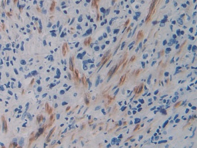 DAB staining on IHC-P; Samples: Human Liver Tissue
