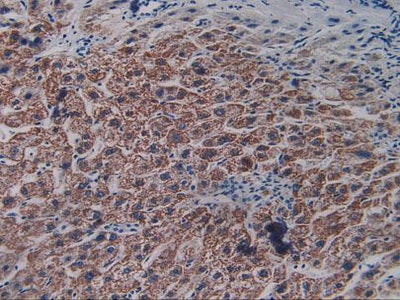 Vascular Endothelial Growth Factor Receptor 2 (VEGFR2) Polyclonal Antibody - image 5