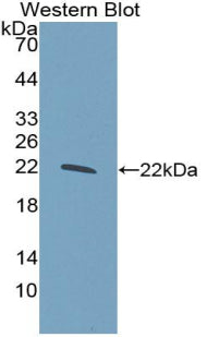 Glucokinase Regulatory Protein (GKRP) Polyclonal Antibody - image 2