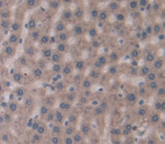 Glucokinase Regulatory Protein (GKRP) Polyclonal Antibody - image 3