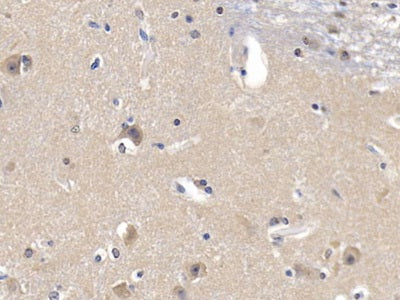 DAB staining on IHC-P. Samples: Human Tissue