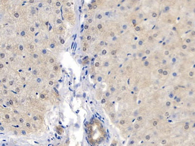 Glucokinase Regulatory Protein (GKRP) Polyclonal Antibody - image 3