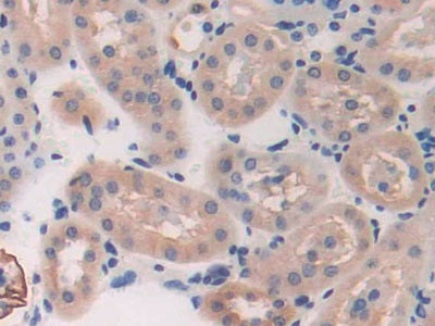 DAB staining on fromalin fixed paraffin-embedded testis tissue)
