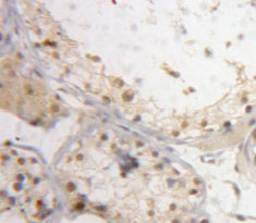 Breast Cancer Susceptibility Protein 2 (BRCA2) Polyclonal Antibody - image 4