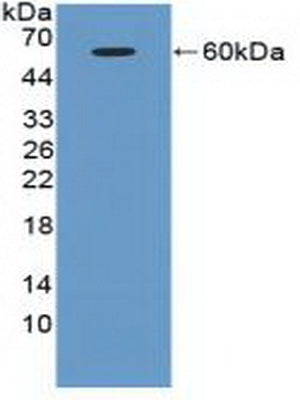 Ataxia Telangiectasia Mutated (ATM) Polyclonal Antibody - image 2