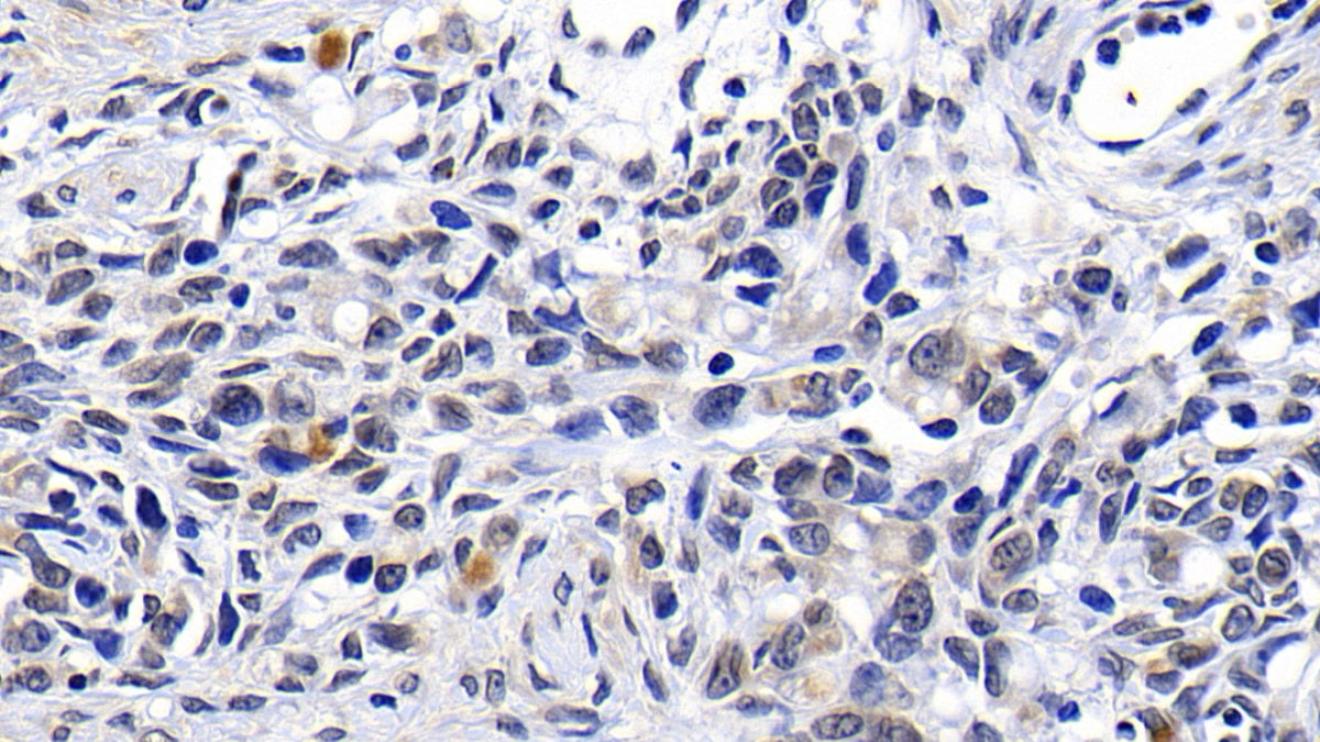 DABstainingonIHC-P.Samples:HumanTissue)