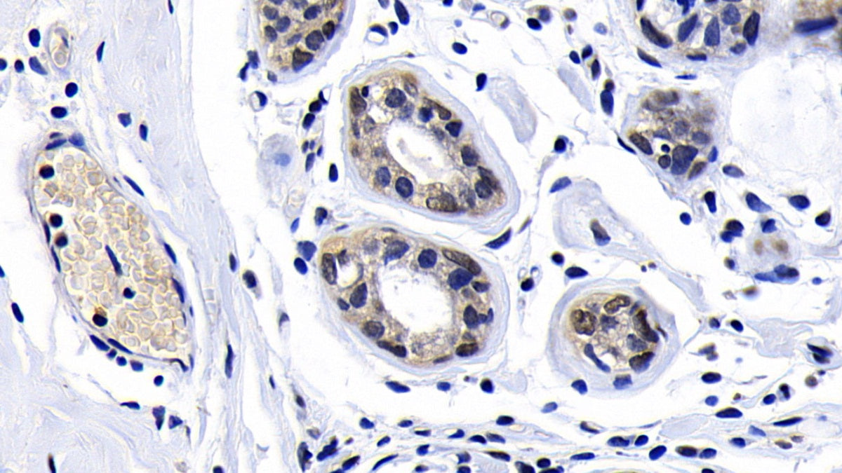 Ataxia Telangiectasia Mutated (ATM) Polyclonal Antibody - image 4