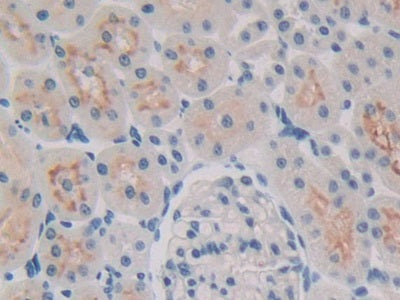DAB staining on fromalin fixed paraffin- embedded Kidney tissue)