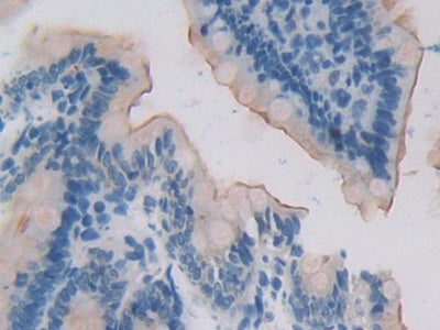 15-Lipoxygenase-2 (15-LO-2) Polyclonal Antibody - image 4
