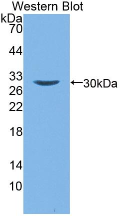 15-Lipoxygenase-2 (15-LO-2) Polyclonal Antibody - image 2