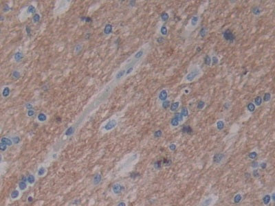 15-Lipoxygenase-2 (15-LO-2) Polyclonal Antibody - image 4