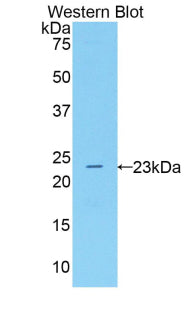 5-Lipoxygenase (5-LO) Polyclonal Antibody - image 2