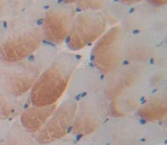5-Lipoxygenase (5-LO) Polyclonal Antibody - image 3