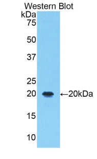 5-Lipoxygenase (5-LO) Polyclonal Antibody - image 2