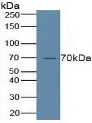 Western Blot; Sample: Recombinant ALOX5, Human.