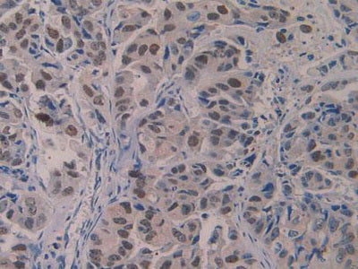 5-Lipoxygenase (5-LO) Polyclonal Antibody - image 5
