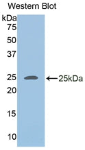 Adipose Differentiation Related Protein (ADRP) Polyclonal Antibody - image 2