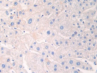 Adipose Differentiation Related Protein (ADRP) Polyclonal Antibody - image 4