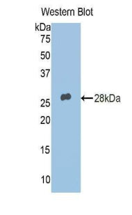 Western Blot; Sample: Human Milk; ; Primary Ab: 2µg/ml Rabbit Anti-Human ADRP Antibody; Second Ab: 0.2µg/mL HRP-Linked Caprine Anti-Rabbit IgG Polyclonal Antibody;