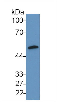 DAB staining on IHC-P; Samples: Human Liver Tissue; Primary Ab: 30µg/ml Rabbit Anti-Human ADRP Antibody Second Ab: 2µg/mL HRP-Linked Caprine Anti-Rabbit IgG Polyclonal Antibody