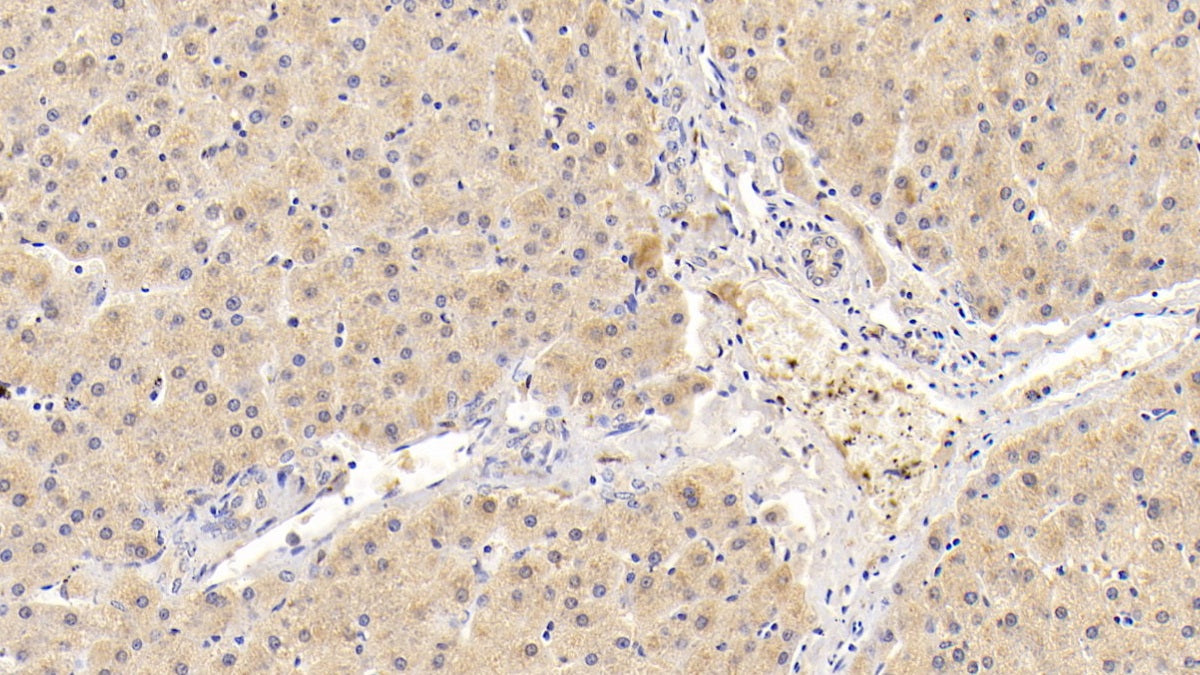 DABstainingonIHC-P.Samples:HumanTissue)