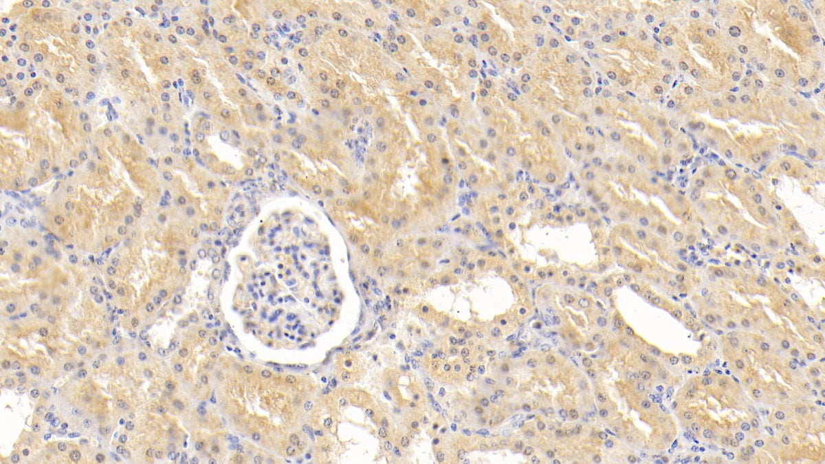 Adipose Differentiation Related Protein (ADRP) Polyclonal Antibody - image 5