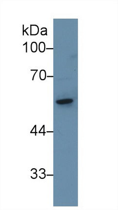 Western Blot; Sample: Recombinant protein.
