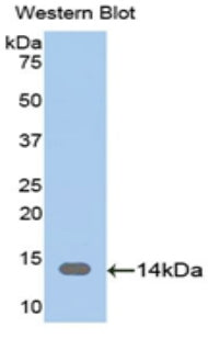 Used in DAB staining on fromalin fixed paraffin-embedded Kidney tissue