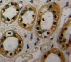 Adenylyl Cyclase Associated Protein 1 (CAP1) Polyclonal Antibody - image 4