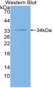Adenylate Cyclase 1, Brain (ADCY1) Polyclonal Antibody - image 2