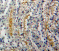 Adenylate Cyclase 1, Brain (ADCY1) Polyclonal Antibody - image 3