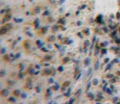 Activating Transcription Factor 1 (ATF1) Polyclonal Antibody - image 4