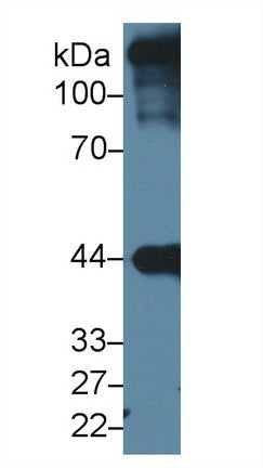 Western Blot; Sample: Recombinant protein.