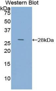 DAB staining on IHC-P; Samples: Human Esophagus Tissue;  Primary Ab: 20µg/ml Rabbit Anti-Human ACTC1