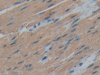 DAB staining on IHC-P; Samples: Human Esophagus Tissue